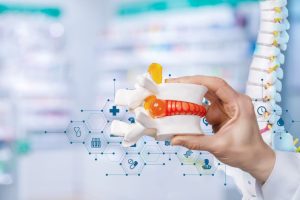 chronic back pain management in Jersey - herniated disc