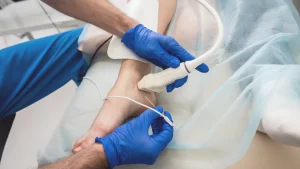 HOW PAINFUL IS RADIOFREQUENCY ABLATION_ 2