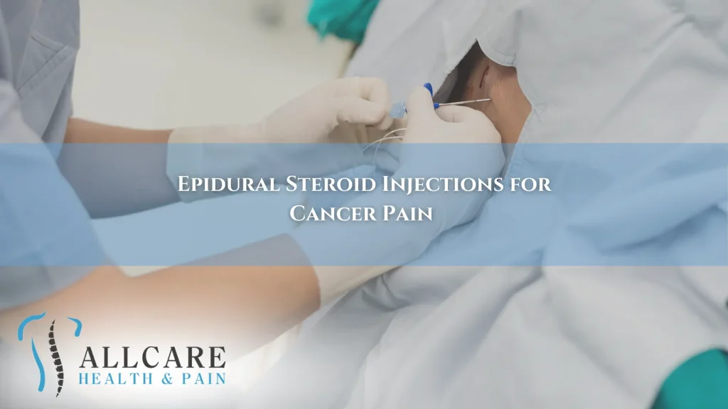 Epidural Steroid Injections for Cancer Pain