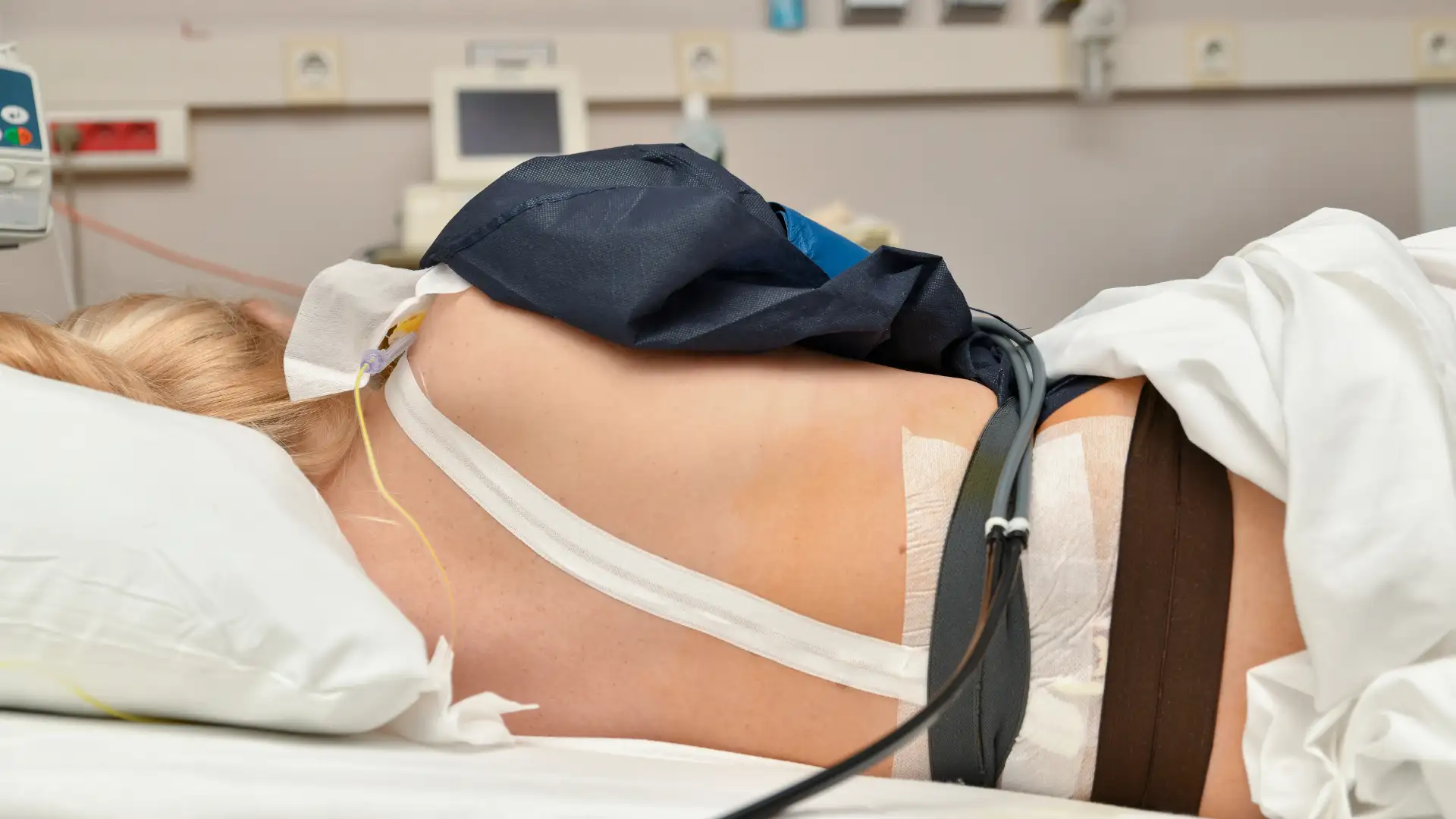 How Long Do Epidural Steroid Injections Last?