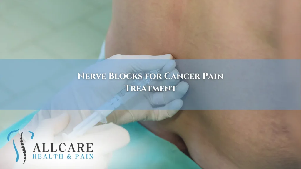 Nerve Blocks for Cancer Pain Treatment