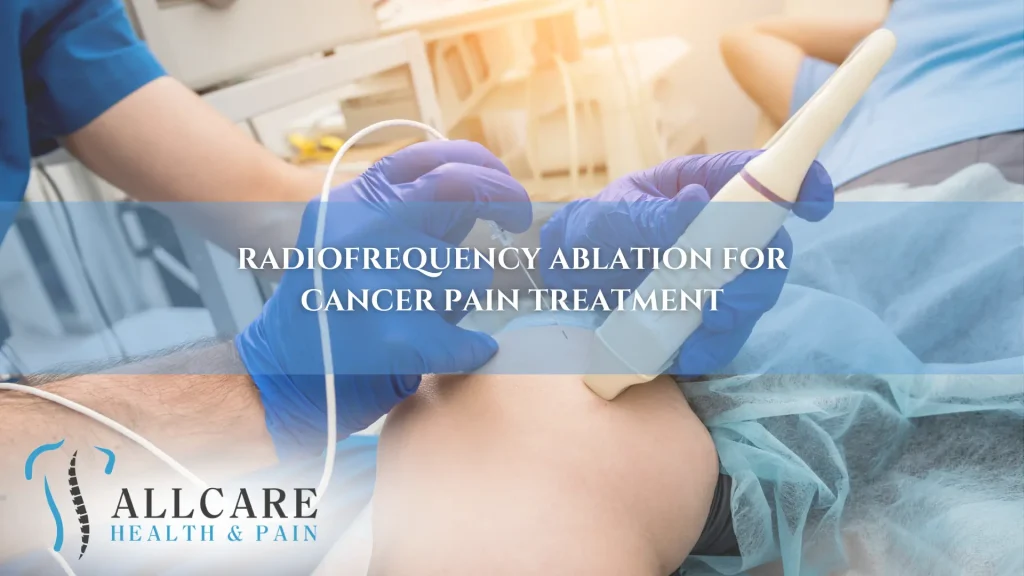 RADIOFREQUENCY ABLATION FOR CANCER PAIN TREATMENT