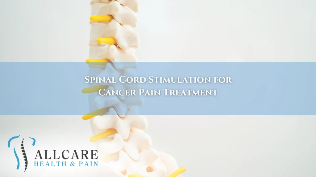 Spinal Cord Stimulation for Cancer Pain Treatment